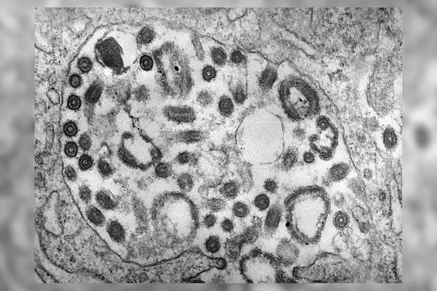 3 Marburg virus deaths confirmed in Ethiopia as authorities step up response