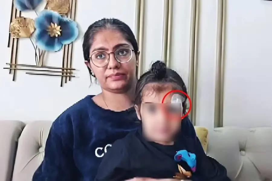 Meerut doctor under fire: Child's wound sealed with Fevikwik instead of stitches