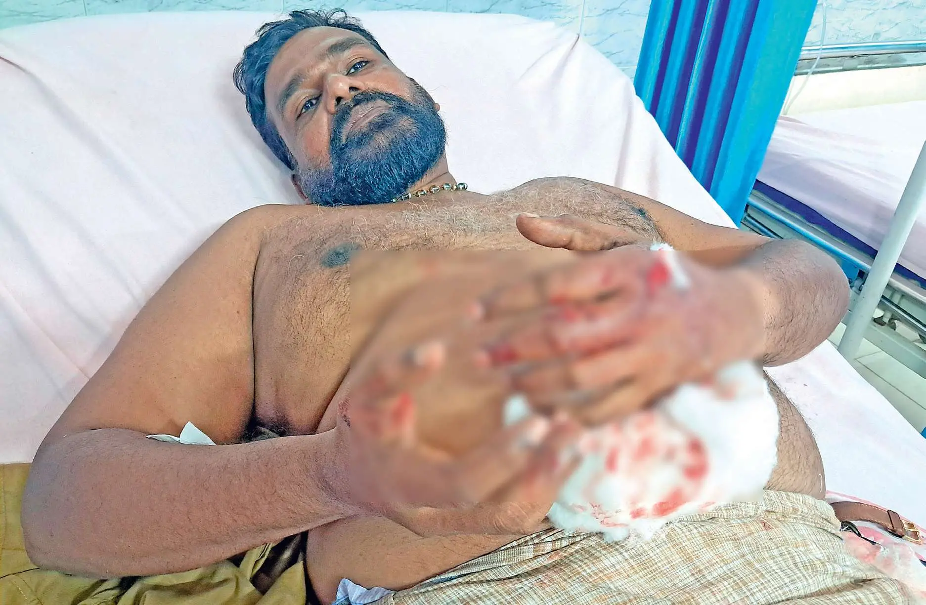പരിക്കേറ്റ വിഷുകുമാർ കടയ്ക്കൽ താലൂക്ക് ആശുപത്രിയിൽ