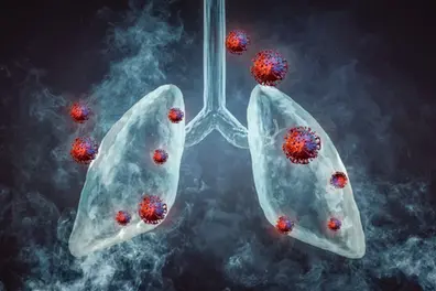 UK researchers develop real-time blood test to track lung cancer