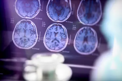 Can we stop Alzheimer’s? Scientists uncover hidden ‘cellular construction crew’ that holds the key