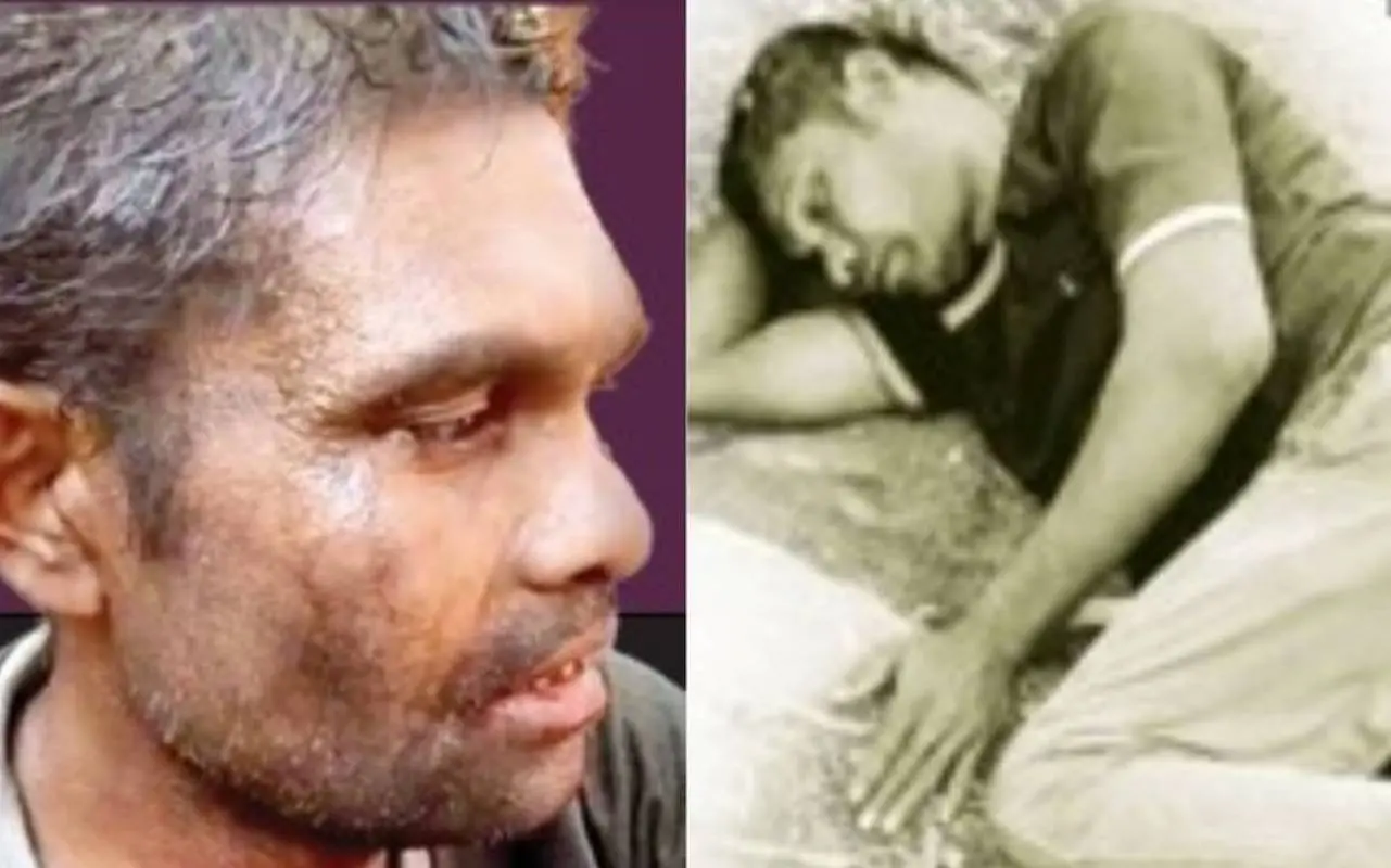രാംനാരായൺ വയ്യാർ, വാളയാർ മാതാളികാട് മർദനമേറ്റ് അവശനിലയിൽ കിടക്കുന്ന രാംനാരായൺ | Photo:mathrubhumi