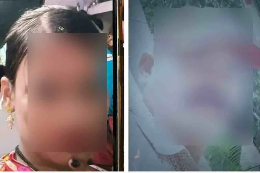 പുതുവത്സര മധുരം നൽകാമെന്ന് പറഞ്ഞ് വിളിച്ചുവരുത്തി; 44-കാരന്റെ സ്വകാര്യഭാഗം കാമുകി മുറിച്ചുമാറ്റി