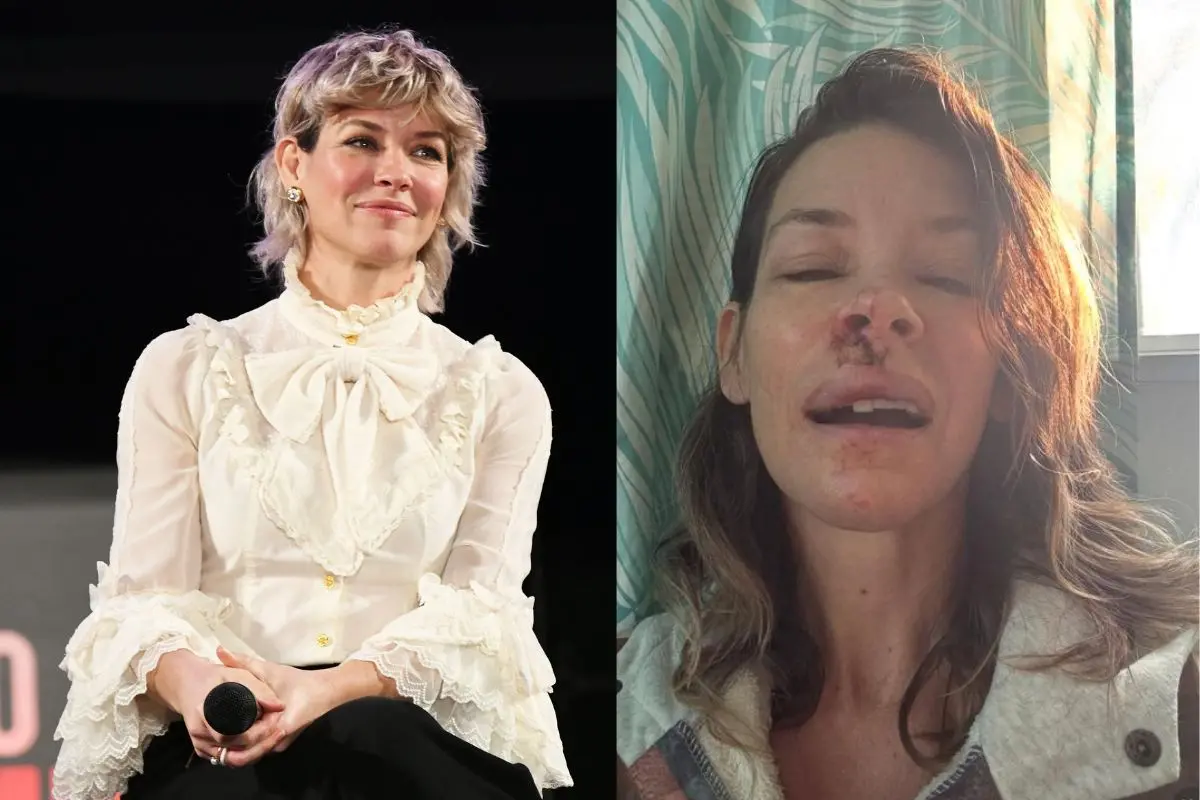 Marvel star Evangeline Lilly reveals 'brain damage' after traumatic fall in new video