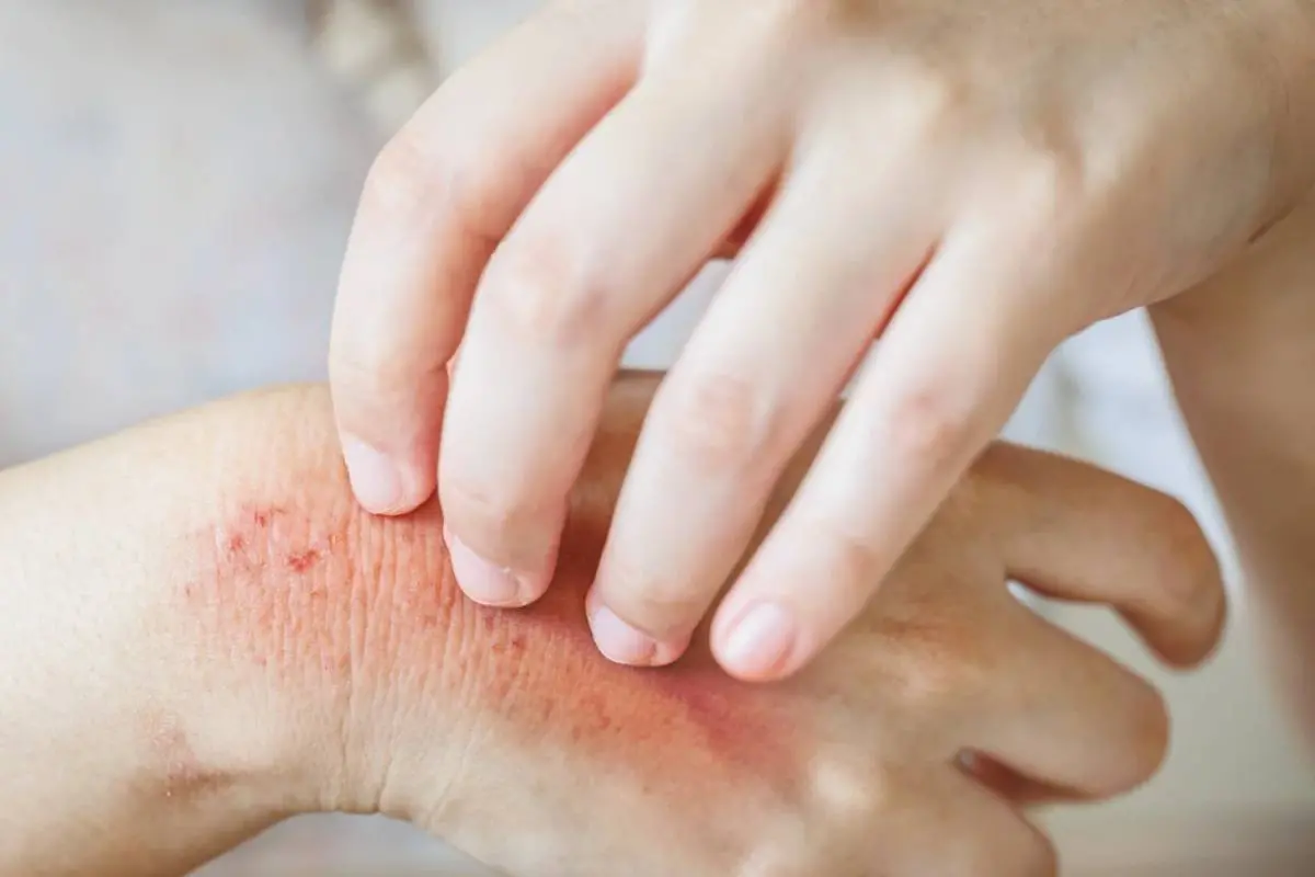 Representative Image| Photo: Canva.com