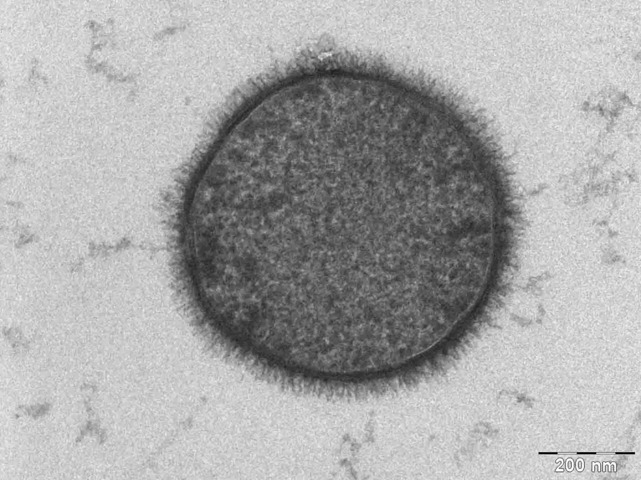 Bacillus Subtilis | English Wikipedia, Public domain, via Wikimedia Commons