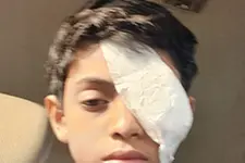 ഗുരുവായൂർ ക്ഷേത്രത്തിൽ ബാരിക്കേഡ് തട്ടി 10 വയസ്സുകാരന്റെ കണ്ണിന് പരിക്ക്