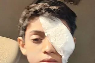 ഗുരുവായൂർ ക്ഷേത്രത്തിൽ ബാരിക്കേഡ് തട്ടി 10 വയസ്സുകാരന്റെ കണ്ണിന് പരിക്ക്