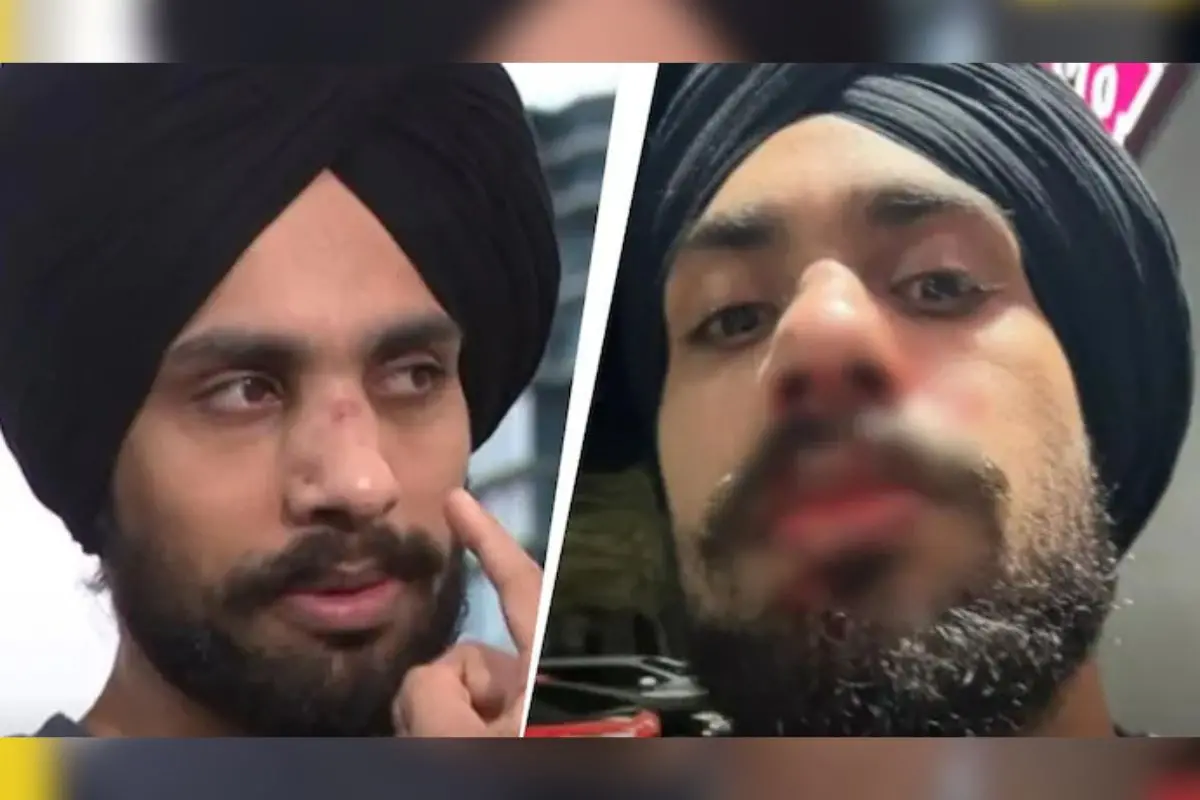 Harmanpreet Singh, the 22-year-old Indian-origin Sikh nurse, shows facial injuries after a suspected hate attack outside a gym in Corio near Geelong, Victoria.