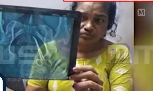 വയറ്റിൽ കുടുങ്ങിയ കത്രിക ദൃശ്യമായ സ്കാൻ റിപ്പോർട്ടുമായി ഉഷ | Image courtesy: Mathrubhumi news screengrab