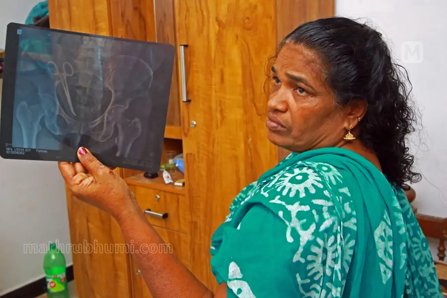ഗുരുതരമായ പിഴവ്, പക്ഷേ ഓർമ്മയില്ല; ഉഷയുടെ വയറ്റിൽ കത്രിക കുടുങ്ങിയ സംഭവത്തിൽ ഡോ. ഷാഹിദ