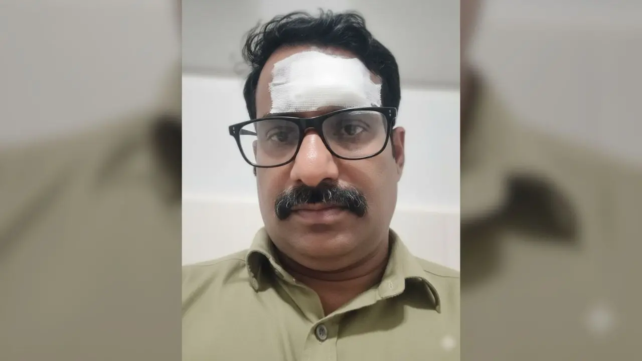 Injured conductor Vinu