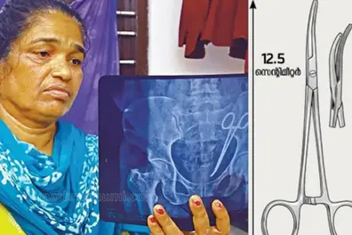 Alappuzha surgery row: 12.5-cm forceps removed from patient’s abdomen – know more