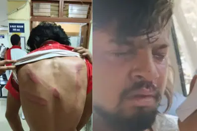 Kerala student among victims as 5 attacked in MP campus assault; complaint names right-wing group