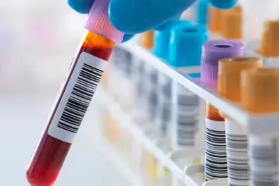 SC seeks details on cost and availability of NAT testing across govt hospitals