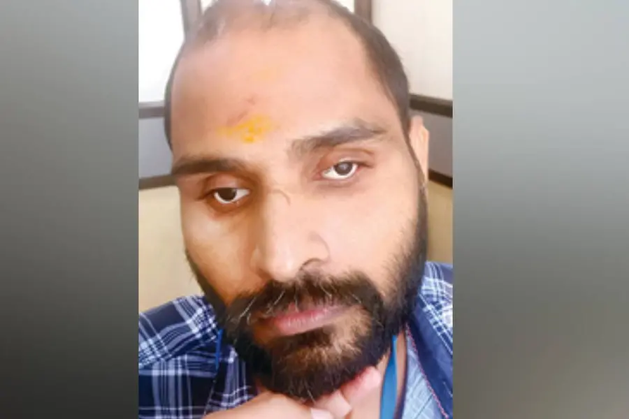 ചികിത്സാ പിഴവിൽ കണ്ണുകൾ നഷ്ടമായെന്ന ആരോപണം; സനൂപിന് ആശ്വാസമേകാൻ കൃത്രിമക്കണ്ണുകൾ
