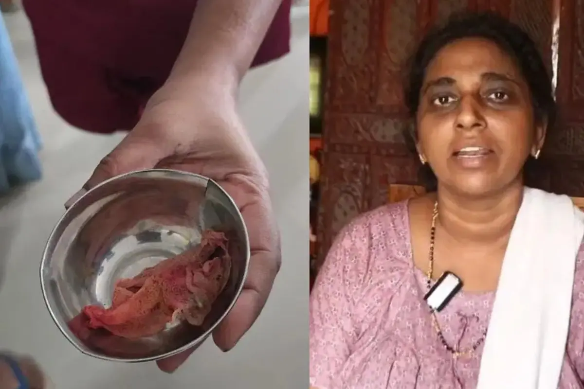 Surgical cloth recovered from Sheeba's abdomen.