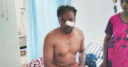 കാട്ടാനയുടെ ആക്രമണത്തിൽ പരിക്കേറ്റ് ചികിത്സയിൽ കഴിയുന്ന സിങ്കുകണ്ടം കൊച്ചുതയ്യിൽ മധു
