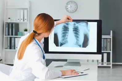 Still believe these TB myths? Doctors reveal real facts