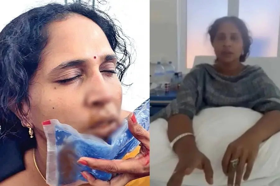 Pulled hair; fractured nose: Indian teacher in Maldives faces attack from Class 8 student