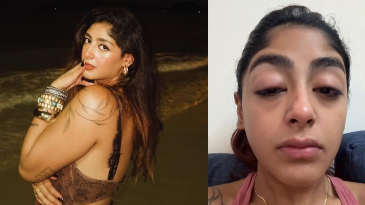 Splitvilla Star Preet Singh Brutally Assaulted, Suffers Severe Facial Injuries
