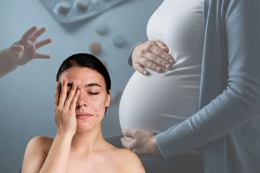 Can acne drugs endanger pregnancy and baby? Kerala study warns risks; experts urge caution
