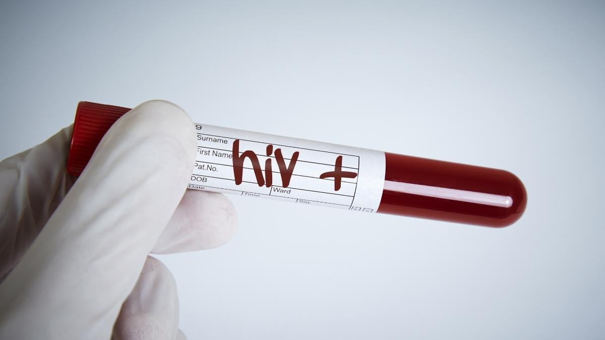 Africa no longer wants to wait for the West: South Africa to produce game-changing HIV injection