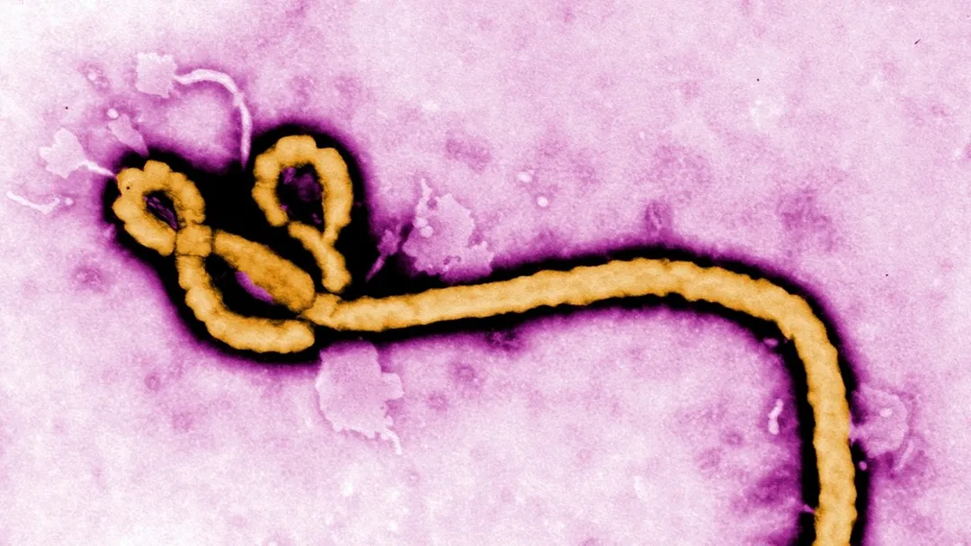 Ebola Outbreak in Congo's Ituri Province: A Looming Health Crisis