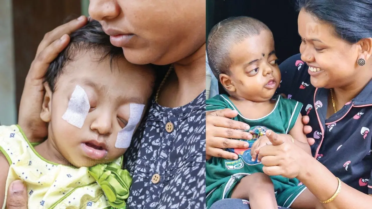 1, കരഞ്ഞാല്‍ കണ്ണുകള്‍ പുറത്തേക്ക് വരുന്ന അപൂര്‍വരോഗം ബാധിച്ച ഒരുവയസുകാരി അദ്വൈത അമ്മ സജിനിയോടൊപ്പം. 2025 ഒക്ടോബര്‍ 18-ന് മാതൃഭൂമി പ്രസിദ്ധീകരിച്ച ചിത്രം | 2, ആറുമാസത്തെ ചികിത്സകൾക്കുശേഷം സുഖംപ്രാപിച്ചുവരുന്ന അദ്വൈത 'അമ്മ സജിനിയോടൊപ്പം | ഫോട്ടോ: ബി. മുരളീകൃഷ്ണൻ