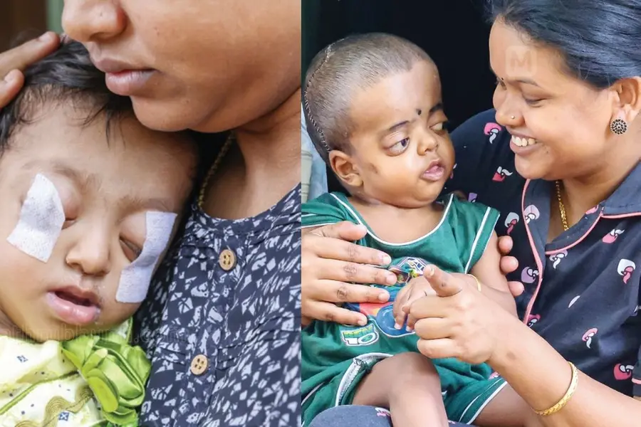കൺനിറയെ കാൺക കൺമണീ... സഹായങ്ങളും പ്രാർത്ഥനകളും ഫലംകണ്ടു; കുഞ്ഞ് അദ്വൈതയ്ക്ക് ഇനി കണ്ണുനിറയെ കാണാം