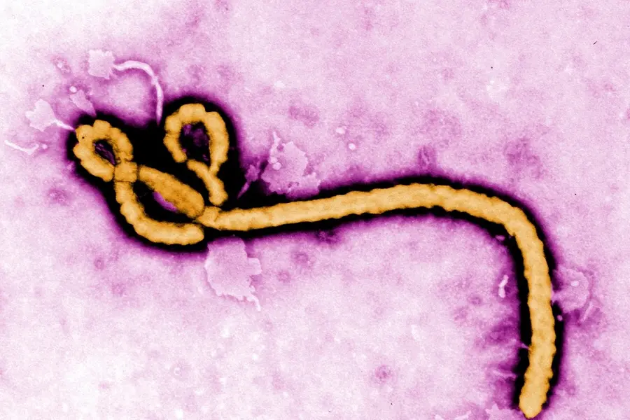 ebola virus