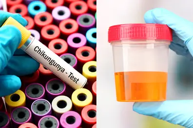 Can Ayurvedic cow urine distillate fight Chikungunya? IIT Roorkee research shows promise