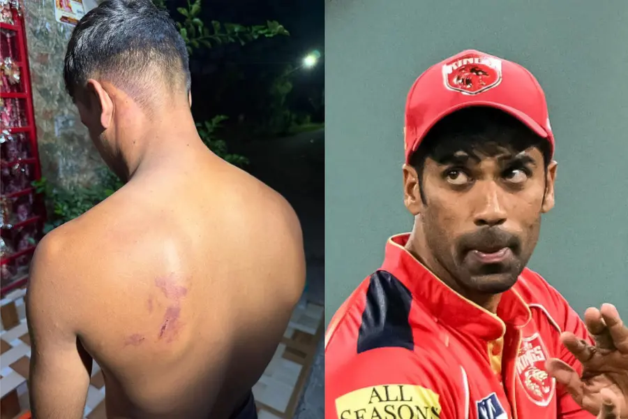 Shashank Singh assault case