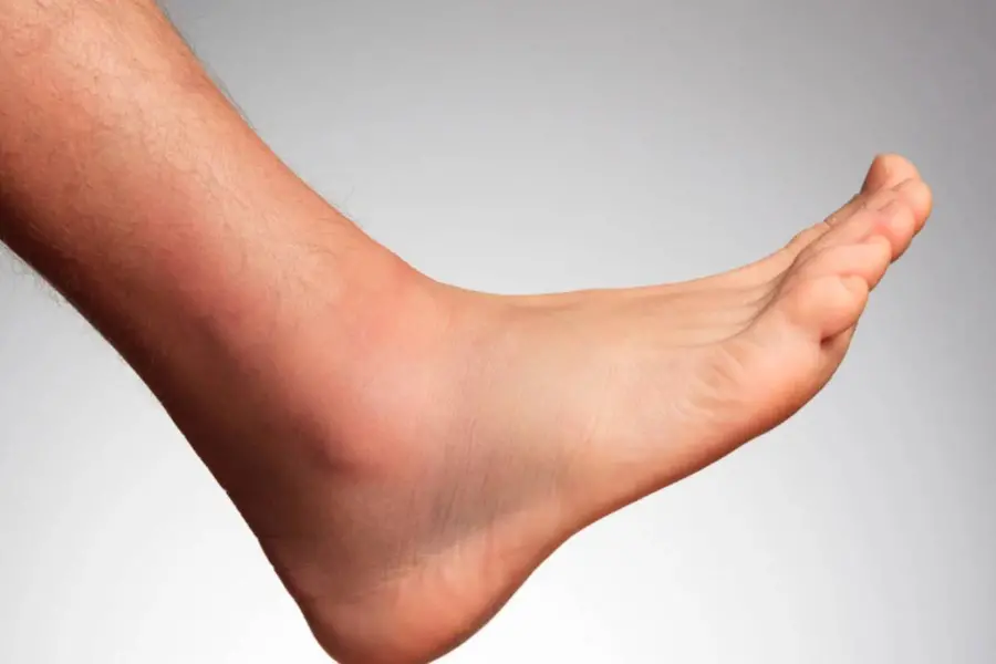 leg