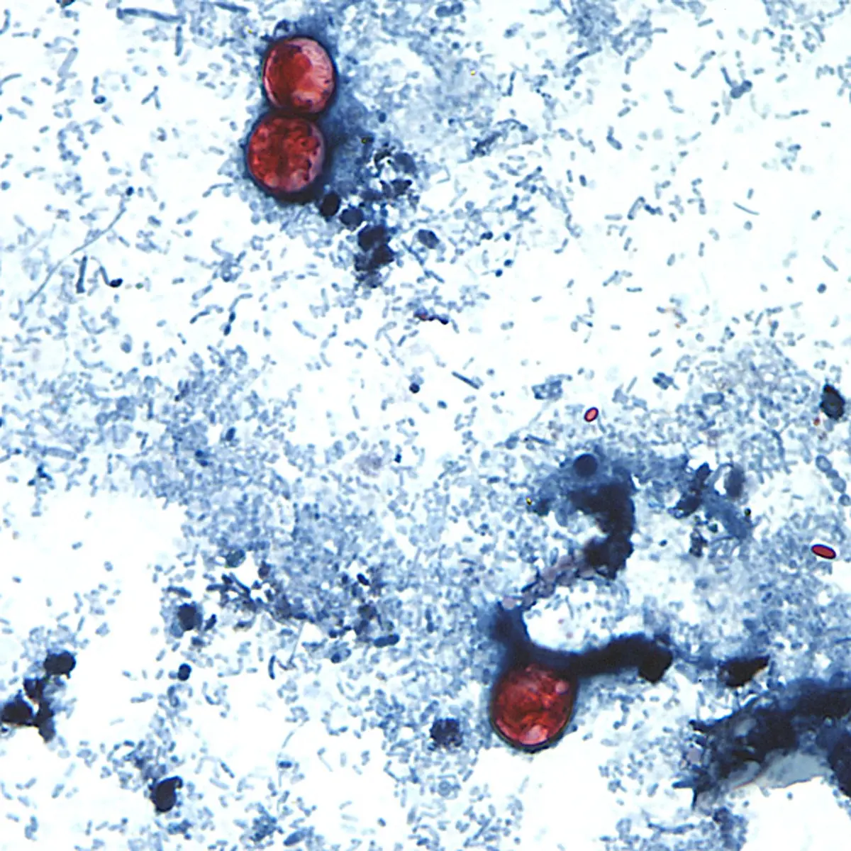 This undated photo taken through a microscope provided by the CDC shows Cyclospora cayetanensis oocysts found in a fresh stool sample which had been prepared with a formalin solution and stained with safranin | Photo: AP