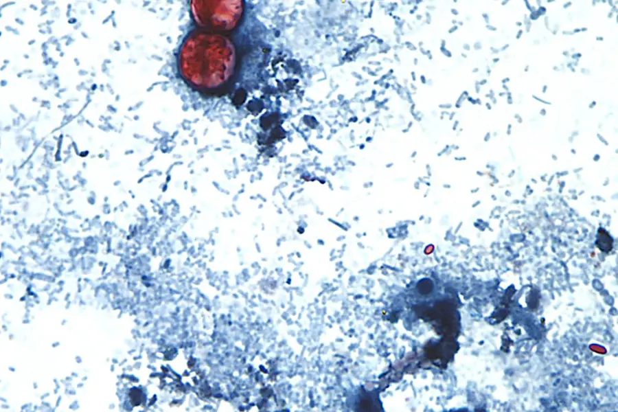 Cyclospora Outbreak