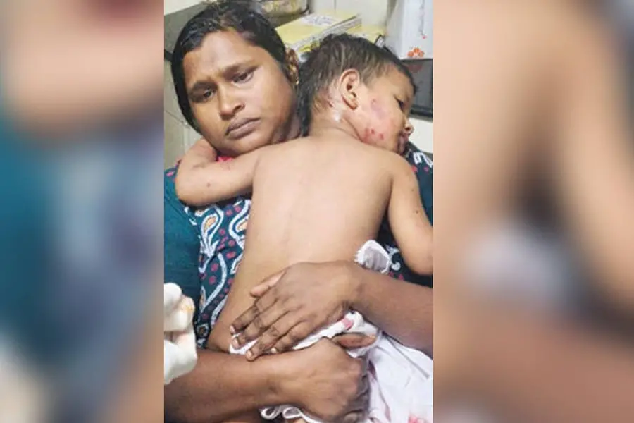 വീട്ടുമുറ്റത്ത് കളിക്കുന്നതിനിടെ തെരുവുനായ ആക്രമണം;ഒന്നര വയസ്സുകാരന്റെ ശരീരത്തിൽ 25 മുറിവുകൾ