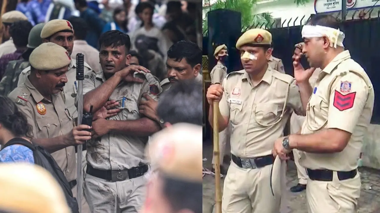 സിജെപി പ്രതിഷേധത്തിൽ പരിക്കേറ്റ പോലീസുകാർ | Photos: AFP, ANI