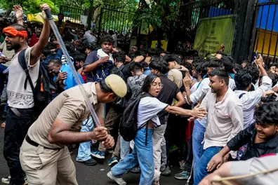 Delhi CJP protest: Critically injured woman off ventilator, recovering well at RML Hospital