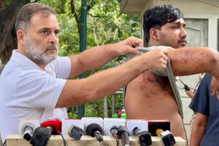 ‘പ്രധാൻ ക്രിമിനൽ മന്ത്രി’; പെല്ലറ്റ് കൊണ്ട് പരിക്കേറ്റ യുവാവുമായി മാധ്യമങ്ങളെ കണ്ട് രാഹുൽ