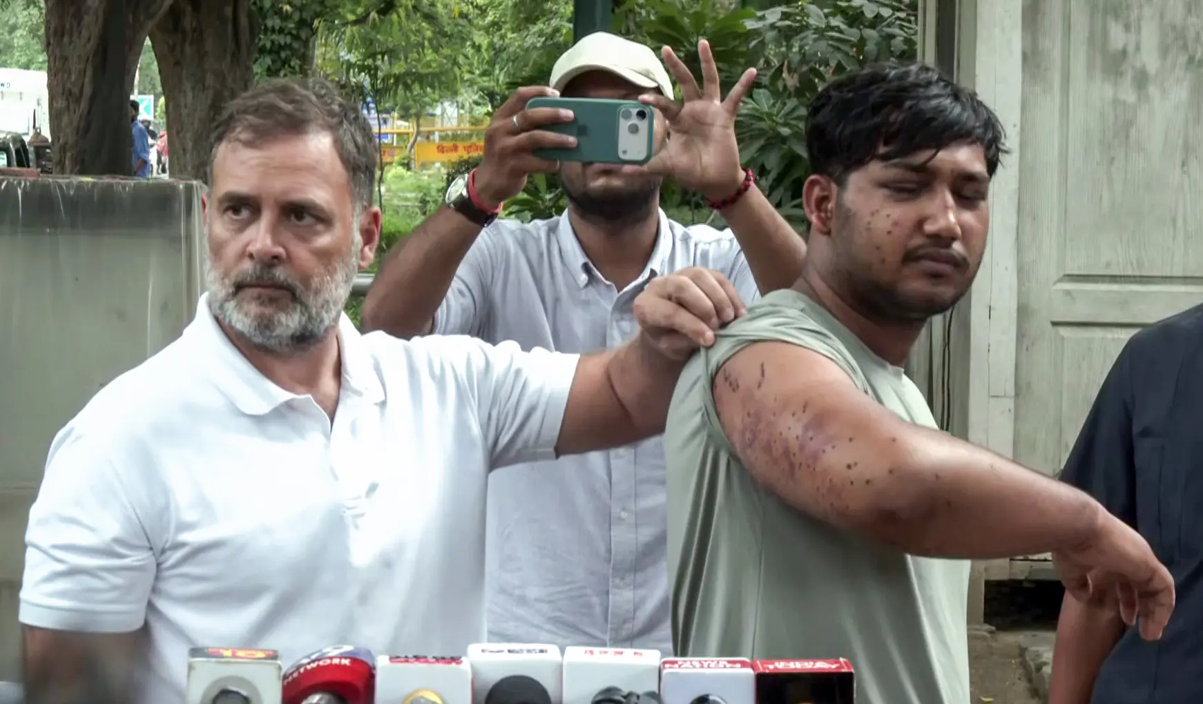 Lok Sabha LoP Rahul Gandhi brings before the media a man he claims suffered pellet gun injuries during students' protest, in New Delhi on Friday. | Photo: ANI Video Grab
