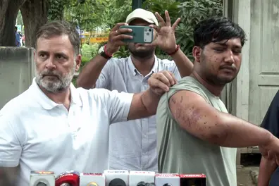 Pellet injury all over body, damaged eye: RAF begins probe into alleged firing during CJP protest