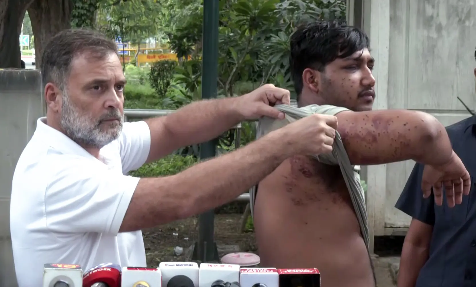 Lok Sabha LoP Rahul Gandhi brings before the media a man he claims suffered pellet gun injuries during students' protest, in New Delhi on Friday