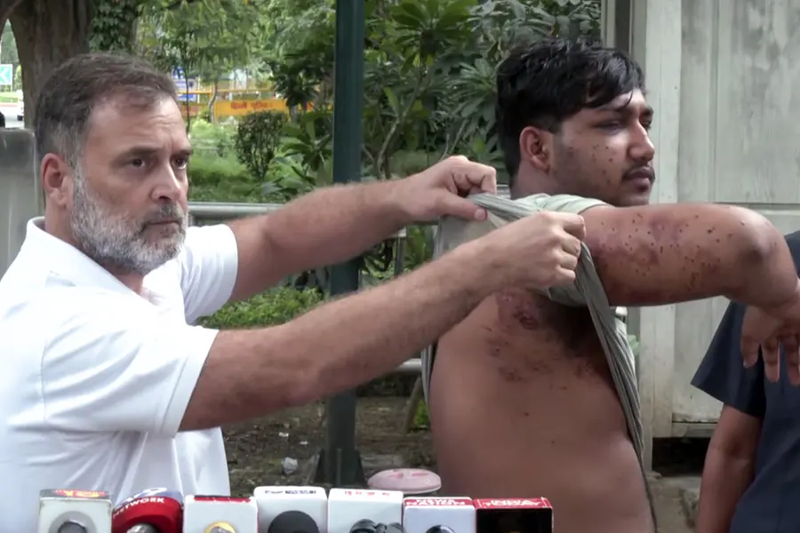 pellet gun injuries