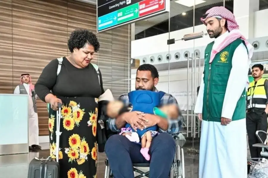 ഫിജിയിൽനിന്നുള്ള ഒട്ടിച്ചേർന്ന ഇരട്ടകൾ ചികിത്സയ്ക്കായി സൗദിയിയിൽ; ശസ്ത്രക്രിയ സാധ്യത പരിശോധിക്കും