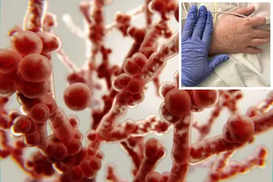 Candida auris outbreak in US: Causes, symptoms, spread and treatment explained
