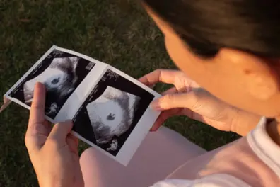 Can this one ultrasound angle really predict your baby's sex?