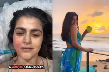 പേരുകേട്ട് പേടിക്കണ്ട സംഗതി സിംപിളാണ്; വാമ്പയർ ഫേഷ്യലിനെ കുറിച്ച് ഷെഹ്നാസ്