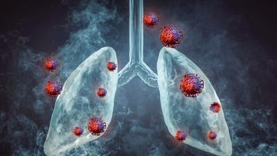 Lung Cancer in Non-Smokers: Causes, Symptoms and Risk Factors You Should Know