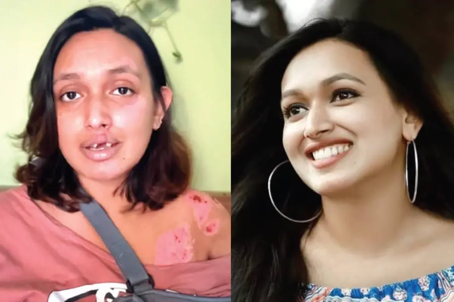 ‘ഞാനറിയുന്ന ഞാനല്ല കണ്ണാടിയിൽ’; സാനിയുടെ ജീവിതം മാറ്റിമറിച്ച ബൈക്ക് അപകടത്തിന് രണ്ടുമാസം
